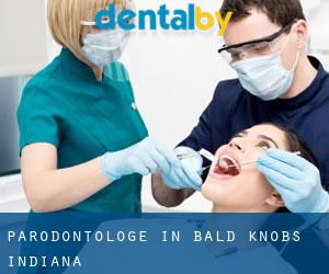 Parodontologe in Bald Knobs (Indiana)