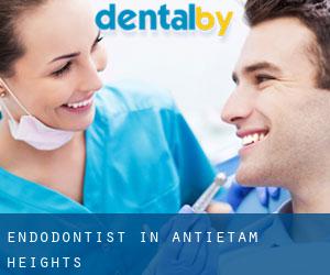Endodontist in Antietam Heights