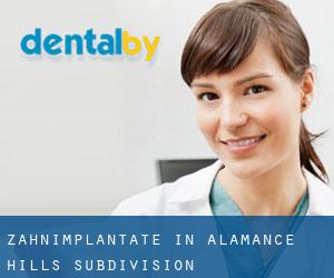 Zahnimplantate in Alamance Hills Subdivision