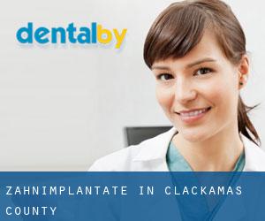 Zahnimplantate in Clackamas County