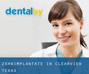 Zahnimplantate in Clearview (Texas)