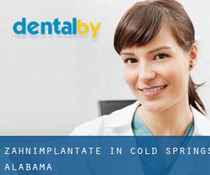 Zahnimplantate in Cold Springs (Alabama)