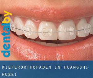 Kieferorthopäden in Huangshi (Hubei) Kieferorthopäden in Huangshi (Hubei)