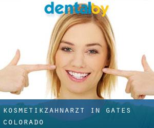 Kosmetikzahnarzt in Gates (Colorado)