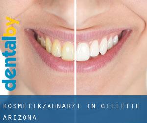 Kosmetikzahnarzt in Gillette (Arizona)