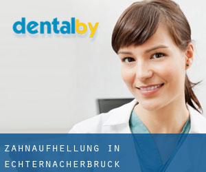 Zahnaufhellung in Echternacherbrück