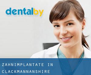 Zahnimplantate in Clackmannanshire