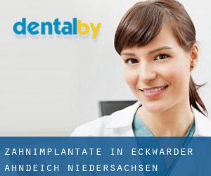 Zahnimplantate in Eckwarder Ahndeich (Niedersachsen)