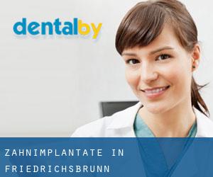 Zahnimplantate in Friedrichsbrunn