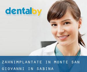Zahnimplantate in Monte San Giovanni in Sabina