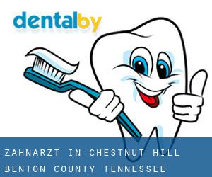 zahnarzt in Chestnut Hill (Benton County, Tennessee)
